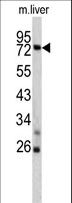 TNFAIP2 Antibody - Western blot of TNFAIP2 antibody in mouse liver lysates (35 ug/lane). TNFAIP2 (arrow) was detected using the purified antibody.