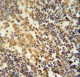 TNFAIP2 Antibody - TNFAIP2 Antibody immunohistochemistry of formalin-fixed and paraffin-embedded human lymph node followed by peroxidase-conjugated secondary antibody and DAB staining.