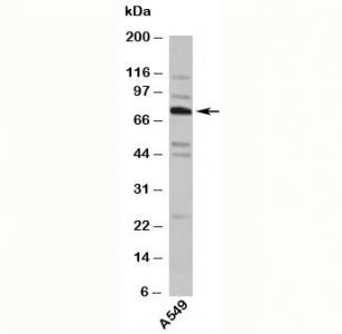 TNFAIP2 Antibody - TNFAIP2 antibody western blot with human samples