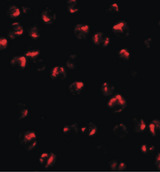 TNFAIP2 Antibody - Immunofluorescence of TNFAIP2 in K562 cells with TNFAIP2 antibody at 20 ug/ml.