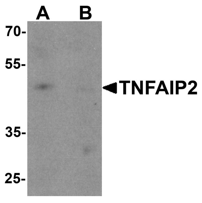 TNFAIP2 Antibody - Western blot analysis of TNFAIP2 in K562 cell lysate with TNFAIP2 antibody at 1 ug/ml in (A) the absence and (B) the presence of blocking peptide.