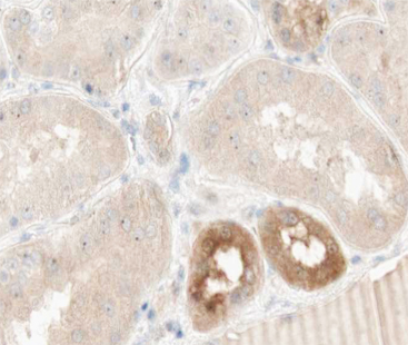 TNFAIP2 Antibody - 1:100 staining human kidney tissue by IHC-P. The tissue was formaldehyde fixed and a heat mediated antigen retrieval step in citrate buffer was performed. The tissue was then blocked and incubated with the antibody for 1.5 hours at 22°C. An HRP conjugated goat anti-rabbit antibody was used as the secondary.