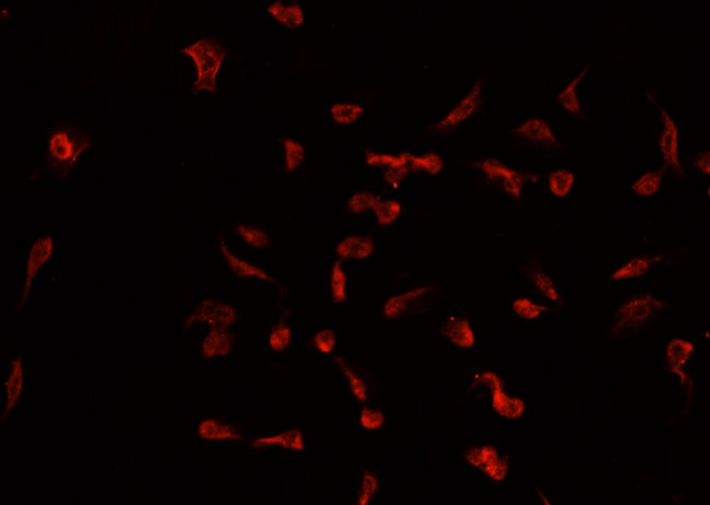 TNFAIP2 Antibody - Staining A549 cells by IF/ICC. The samples were fixed with PFA and permeabilized in 0.1% Triton X-100, then blocked in 10% serum for 45 min at 25°C. The primary antibody was diluted at 1:200 and incubated with the sample for 1 hour at 37°C. An Alexa Fluor 594 conjugated goat anti-rabbit IgG (H+L) antibody, diluted at 1/600, was used as secondary antibody.