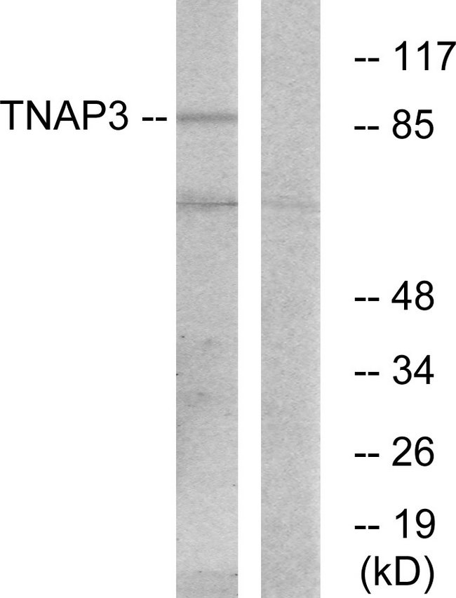 TNFAIP3 / A20 Antibody - Western blot analysis of lysates from RAW264.7 cells, using TNAP3 Antibody. The lane on the right is blocked with the synthesized peptide.