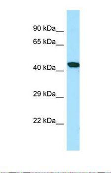 TNFAIP3 / A20 Antibody - Western blot of Human ACHN whole cell lysate. TNFAIP3 antibody dilution 1.0 ug/ml.  This image was taken for the unconjugated form of this product. Other forms have not been tested.