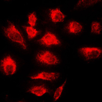 TNFAIP3 / A20 Antibody - Immunofluorescent analysis of A20 staining in HeLa cells. Formalin-fixed cells were permeabilized with 0.1% Triton X-100 in TBS for 5-10 minutes and blocked with 3% BSA-PBS for 30 minutes at room temperature. Cells were probed with the primary antibody in 3% BSA-PBS and incubated overnight at 4 C in a humidified chamber. Cells were washed with PBST and incubated with a DyLight 594-conjugated secondary antibody (red) in PBS at room temperature in the dark. DAPI was used to stain the cell nuclei (blue).