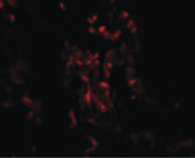 TNFAIP3 / A20 Antibody - Immunofluorescence of TNFAIP3 in Human Lung cells with TNFAIP3 antibody at 20 ug/ml.