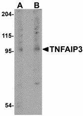 TNFAIP3 / A20 Antibody - Western blot of TNFAIP3 in rat lung tissue lysate with TNFAIP3 antibody at (A) 1 and (B) 2 ug/ml. Below: Immunohistochemistry of TNFAIP3 in human lung tissue with TNFAIP3 antibody at 5 ug/ml.