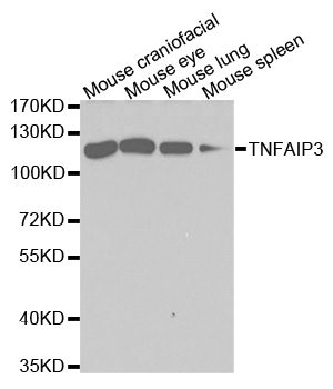 TNFAIP3 / A20 Antibody - Western blot analysis of extracts of various cell lines, using TNFAIP3 antibody.
