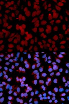 TNFAIP3 / A20 Antibody - Immunofluorescence analysis of U2OS cell using TNFAIP3 antibody. Blue: DAPI for nuclear staining.