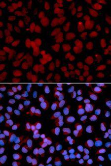 TNFAIP3 / A20 Antibody - Immunofluorescence analysis of U2OS cells using TNFAIP3 antibody. Blue: DAPI for nuclear staining.