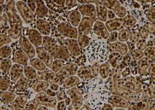 TNFAIP3 / A20 Antibody - 1:100 staining rat kidney tissue by IHC-P. The sample was formaldehyde fixed and a heat mediated antigen retrieval step in citrate buffer was performed. The sample was then blocked and incubated with the antibody for 1.5 hours at 22°C. An HRP conjugated goat anti-rabbit antibody was used as the secondary.