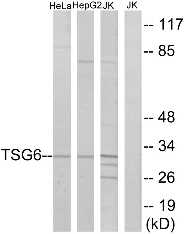 TNFAIP6 / TSG-6 Antibody - Western blot analysis of lysates from Jurkat, HeLa, and HepG2 cells, using TSG6 Antibody. The lane on the right is blocked with the synthesized peptide.