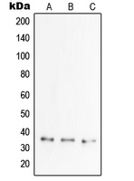 TNFAIP6 / TSG-6 Antibody - Western blot analysis of TSG6 expression in MCF7 (A); HCT15 (B); HeLa (C) whole cell lysates.