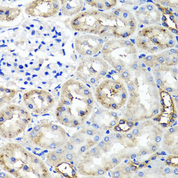 TNFAIP6 / TSG-6 Antibody - Immunohistochemistry of paraffin-embedded rat kidney using TNFAIP6 antibody at dilution of 1:100 (x40 lens).