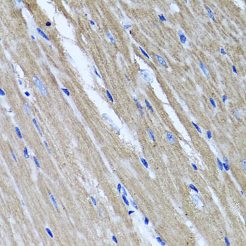 TNFAIP6 / TSG-6 Antibody - Immunohistochemistry of paraffin-embedded mouse heart using TNFAIP6 antibody at dilution of 1:100 (x40 lens).