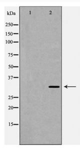 TNFAIP6 / TSG-6 Antibody - Western blot of TSG6 expression in HeLa cells