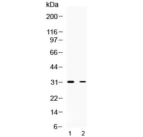 TNFAIP6 / TSG-6 Antibody - Western blot testing of 1) rat brain and 2) human HeLa lysate with TSG6 antibody at 0.5ug/ml. Predicted molecular weight ~31 kDa.