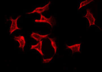 TNFAIP6 / TSG-6 Antibody - Staining HeLa cells by IF/ICC. The samples were fixed with PFA and permeabilized in 0.1% Triton X-100, then blocked in 10% serum for 45 min at 25°C. The primary antibody was diluted at 1:200 and incubated with the sample for 1 hour at 37°C. An Alexa Fluor 594 conjugated goat anti-rabbit IgG (H+L) Ab, diluted at 1/600, was used as the secondary antibody.
