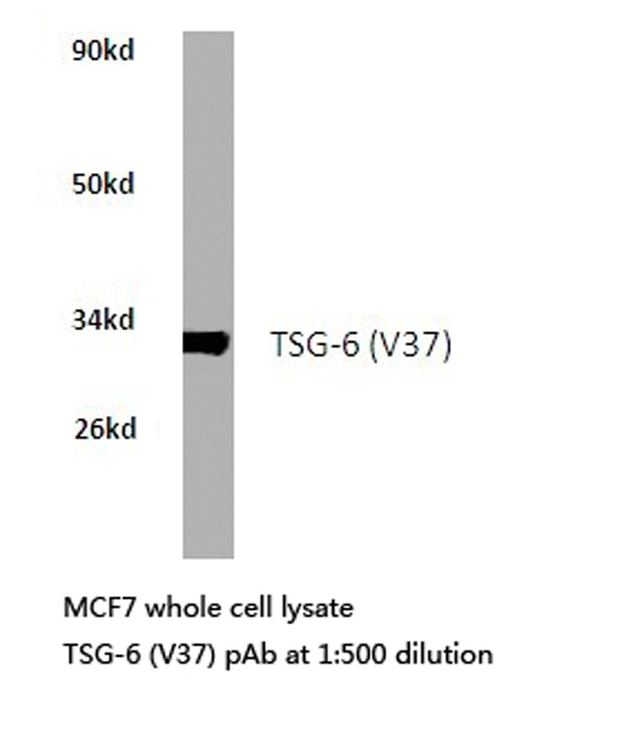 TNFAIP6 / TSG-6 Antibody - Western blot of TSG-6 (V37) pAb in extracts from MCF7 cells.