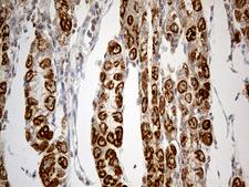 TNFAIP8 / SCC-S2 Antibody - Immunohistochemical staining of paraffin-embedded Human gastric tissue within the normal limits using anti-TNFAIP8 mouse monoclonal antibody. (Heat-induced epitope retrieval by 1mM EDTA in 10mM Tris buffer. (pH8.5) at 120°C for 3 min. (1:250)