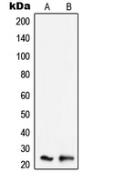 TNFAIP8 / SCC-S2 Antibody - Western blot analysis of SCC-S2 expression in K562 (A); Raw264.7 (B) whole cell lysates.