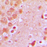 TNFAIP8 / SCC-S2 Antibody - Immunohistochemical analysis of SCC-S2 staining in human brain formalin fixed paraffin embedded tissue section. The section was pre-treated using heat mediated antigen retrieval with sodium citrate buffer (pH 6.0). The section was then incubated with the antibody at room temperature and detected using an HRP conjugated compact polymer system. DAB was used as the chromogen. The section was then counterstained with hematoxylin and mounted with DPX.