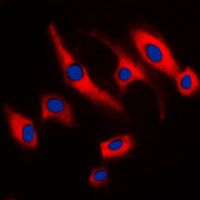 TNFAIP8 / SCC-S2 Antibody - Immunofluorescent analysis of SCC-S2 staining in Raw264.7 cells. Formalin-fixed cells were permeabilized with 0.1% Triton X-100 in TBS for 5-10 minutes and blocked with 3% BSA-PBS for 30 minutes at room temperature. Cells were probed with the primary antibody in 3% BSA-PBS and incubated overnight at 4 C in a humidified chamber. Cells were washed with PBST and incubated with a DyLight 594-conjugated secondary antibody (red) in PBS at room temperature in the dark. DAPI was used to stain the cell nuclei (blue).