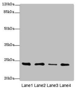 TNFAIP8 / SCC-S2 Antibody - Western blot All Lanes: TNFAIP8antibody at 2.79ug/ml Lane 1 : A431 whole cell lysate Lane 2 : PC-3 whole cell lysate Lane 3 : Human placenta tissue Lane 4 : Mouse thymus tissue Secondary Goat polyclonal to Rabbit IgG at 1/10000 dilution Predicted band size: 24,23,22,25 kDa Observed band size: 23 kDa