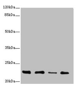 TNFAIP8 / SCC-S2 Antibody - Western blot All lanes: TNFAIP8 antibody at 2.79µg/ml Lane 1: A431 whole cell lysate Lane 2: PC-3 whole cell lysate Lane 3: Human placenta tissue Lane 4: Mouse thymus tissue Secondary Goat polyclonal to rabbit IgG at 1/10000 dilution Predicted band size: 24, 23, 22, 25 kDa Observed band size: 22 kDa