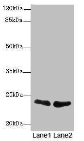 TNFAIP8 / SCC-S2 Antibody - Western blot All Lanes: TNFAIP8antibody at 2.32ug/ml Lane 1 : A431 whole cell lysate Lane 2 : PC-3 whole cell lysate Secondary Goat polyclonal to Rabbit IgG at 1/10000 dilution Predicted band size: 24,23,22,25 kDa Observed band size: 23 kDa