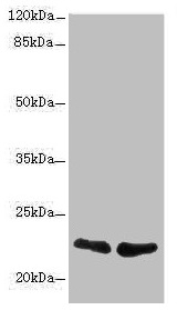 TNFAIP8 / SCC-S2 Antibody - Western blot All lanes: TNFAIP8 antibody at 2.32µg/ml Lane 1: A431 whole cell lysate Lane 2: PC-3 whole cell lysate Secondary Goat polyclonal to rabbit IgG at 1/10000 dilution Predicted band size: 24, 23, 22, 25 kDa Observed band size: 22 kDa