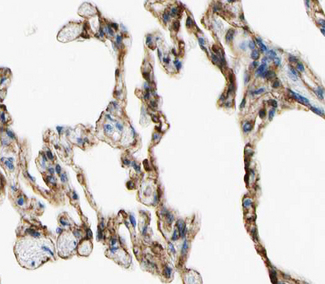 TNFAIP8 / SCC-S2 Antibody - 1:100 staining human lung tissue by IHC-P. The tissue was formaldehyde fixed and a heat mediated antigen retrieval step in citrate buffer was performed. The tissue was then blocked and incubated with the antibody for 1.5 hours at 22°C. An HRP conjugated goat anti-rabbit antibody was used as the secondary.