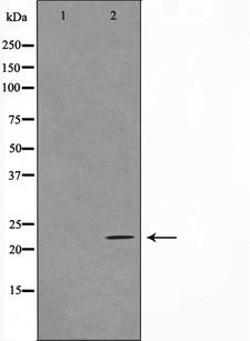 TNFAIP8 / SCC-S2 Antibody - Western blot analysis on HuvEc cell lysates using TFIP8 antibody. The lane on the left is treated with the antigen-specific peptide.