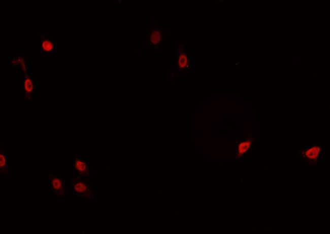 TNFAIP8 / SCC-S2 Antibody - Staining HeLa cells by IF/ICC. The samples were fixed with PFA and permeabilized in 0.1% Triton X-100, then blocked in 10% serum for 45 min at 25°C. The primary antibody was diluted at 1:200 and incubated with the sample for 1 hour at 37°C. An Alexa Fluor 594 conjugated goat anti-rabbit IgG (H+L) antibody, diluted at 1/600, was used as secondary antibody.