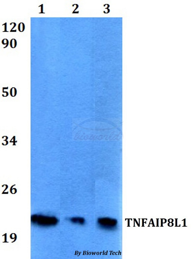 TNFAIP8L1 Antibody - Western blot of TNFAIP8L1 antibody at 1:500 dilution. Lane 1: MCF-7 whole cell lysate. Lane 2: Raw264.7 whole cell lysate. Lane 3: PC12 whole cell lysate.