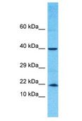 TNFAIP8L2 Antibody - TNFAIP8L2 antibody Western Blot of MCF7. Antibody dilution: 1 ug/ml.  This image was taken for the unconjugated form of this product. Other forms have not been tested.