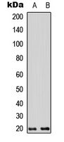 TNFAIP8L2 Antibody - Western blot analysis of TNFAIP8L2 expression in HEK293T (A); MCF7 (B) whole cell lysates.