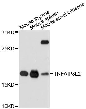 TNFAIP8L2 Antibody - Western blot analysis of extracts of various cell lines, using TNFAIP8L2 antibody at 1:3000 dilution. The secondary antibody used was an HRP Goat Anti-Rabbit IgG (H+L) at 1:10000 dilution. Lysates were loaded 25ug per lane and 3% nonfat dry milk in TBST was used for blocking. An ECL Kit was used for detection and the exposure time was 90s.