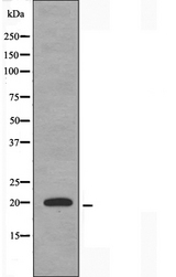 TNFAIP8L2 Antibody - Western blot analysis of extracts of HuvEc cells using TNFAIP8L2 antibody.