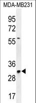 TNFAIP8L3 Antibody - TNFAIP8L3 Antibody western blot of MDA-MB231 cell line lysates (35 ug/lane). The TNFAIP8L3 antibody detected the TNFAIP8L3 protein (arrow).