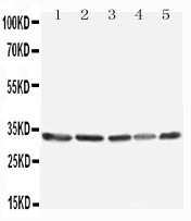 TNFAIP8L3 Antibody - WB of TNFAIP8L3 antibody. All lanes: Anti-TNFAIP8L3 at 0.5ug/ml. Lane 1: MCF-7 Whole Cell Lysate at 40ug. Lane 2: SW620 Whole Cell Lysate at 40ug. Lane 3: COS7 Whole Cell Lysate at 40ug. Lane 4: SKOV Whole Cell Lysate at 40ug. Lane 5: JURKAT Whole Cell Lysate at 40ug. Predicted bind size: 33KD. Observed bind size: 33KD.
