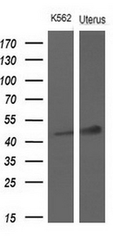 TNFRSF10A / DR4 Antibody - Western blot analysis of extracts. (10ug) from 1 cell line and 1 human tissue by using anti-TNFRSF10A monoclonal antibody at 1:200 dilution.