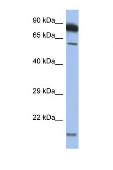 TNFRSF10A / DR4 Antibody - TNFRSF10A / DR4 antibody Western blot of ACHN Cell lysate. Antibody concentration 1 ug/ml.  This image was taken for the unconjugated form of this product. Other forms have not been tested.