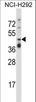 TNFRSF10A / DR4 Antibody - TNFRSF10A Antibody western blot of NCI-H292 cell line lysates (35 ug/lane). The TNFRSF10A antibody detected the TNFRSF10A protein (arrow).