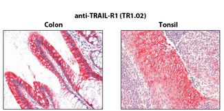 TNFRSF10A / DR4 Antibody - Immunohistochemistry detection of endogenous TRAIL-R1 in paraffin-embedded human carcinoma tissues (colon, tonsil) using mAb to TRAIL-R1 (TR1.02) .
