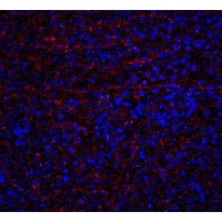 TNFRSF10A / DR4 Antibody - Immunofluorescence of DR3 in human spleen tissue with DR3 antibody at 20 µg/ml.