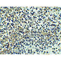TNFRSF10A / DR4 Antibody - Immunohistochemistry of DR4 in human spleen tissue with DR4 antibody at 5 µg/mL.
