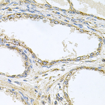 TNFRSF10A / DR4 Antibody - Immunohistochemistry of paraffin-embedded human prostate.