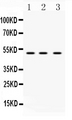 TNFRSF10A / DR4 Antibody - Western blot - Anti-DR4 Picoband Antibody